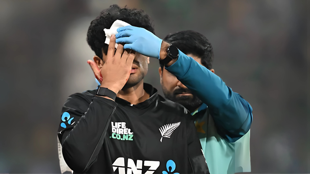 Rachin Ravindra’s Scary Head Injury: What Really Happened?